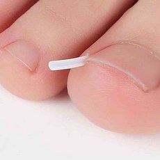 엠비아7 발톱 관리 와이어 팁 10p 발톱관리기, 내향발톱팁10p