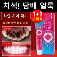 [입냄새 제거 및 잇몸 케어] 베이킹소다 효소 화이트닝 치약 미백 치약 추천 1 위, 1+1 개