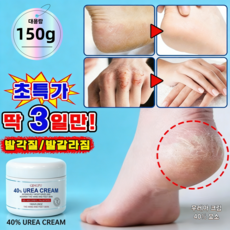 풋크림 우레아크림 고보습 발각질제거크림 발각질층 연화 고보습 힐링 수족 요소크림 보습 균열방지 수족 요소크림 크림 100% 우레아 풋, 150g, 1개, 150g, 1개입