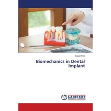 (영문도서)Biomechanics in Dental Implant Paperback, LAP Lambert Academic Publis..., English, 9786208446444