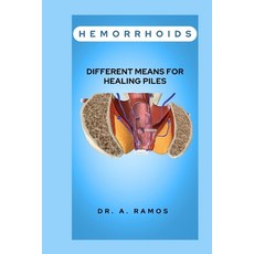 (영문도서) Hemorrhoids: Different Means for Healing Piles Paperback, Independently Published, English, 9798878881753