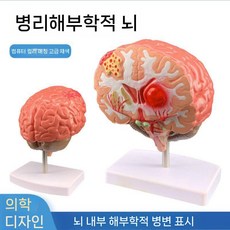 뇌해부학 뇌모형 교육 교구 병원 실습 뇌혈관 인체 과학, 병리학적뇌모델