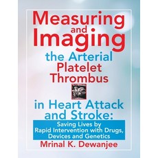 (영문도서) Measuring and Imaging the Arterial Platelet Thrombus in Heart Attack and Stroke: : Saving Liv... Paperback, iUniverse, English, 9781663212030