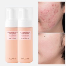 불란케 에이씨 리밸런싱 여드름 기능성 청소년 약산성 폼클렌징, 2개, 150ml