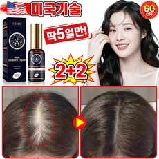 [빠른효과] 미국기술 1/1+1/2+2 두피 영양제 머리 발모제 모발 성장 촉진 에센스 탈모 방지 완화 두피케어 세럼 포장증정, 4개, 30ml