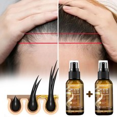 탈모 치료/머릿결개선/모발 강인화, 2개, 20ml