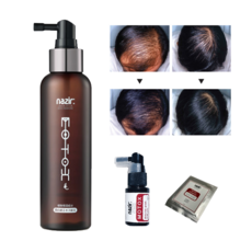 [모톡스 + 샴푸 브러쉬] 탈모토닉 여성 남성 두피 영양제 탈모 완화 방지 예방, 1개, 150ml