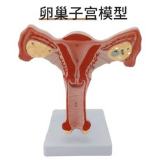 자궁 모형 병리학 건강한 모델 해부학 표본 분만 교육용 골격 여성 생식기관 모델 1., 난소와 자궁  지침 카드 포함