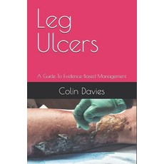 (영문도서)Leg Ulcers: A Guide To Evidence-Based Management Paperback, Independently Published, English, 9798269249629