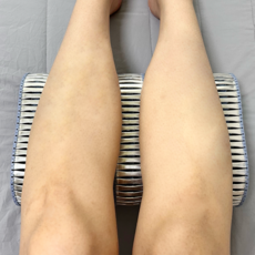 하지불안증후군 다리베개 발베개 수면용품 통증완화 수면장애 편안한 숙면 에크봄증후군