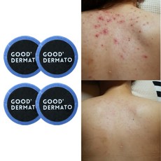 굿더마토 Mint for 데코르테 바디바 (등가슴 몸트러블 싹! 등드름 좁쌀 햇빛알러지 딥클렌징 천연수제비누 워시), 115g, 1개, 4개입