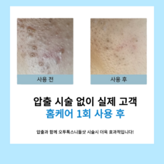 니들샷 리들샷 스피큘 앰플 세럼 모공필링 각질 피부탄력 물광 오투톡스필 약초필 해초칠, 1개, 30ml
