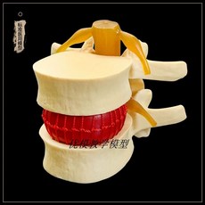 요추 디스크 모형 인체모형 사람인체구조 해부학교육, B. 노란색