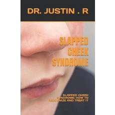 (영문도서) Slapped Cheek Syndrome: Slapped Cheek Syndrome: How to Recognize and Treat It Paperback, Independently Published, English, 9798399439969
