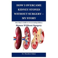 (영문도서) How I Overcame Kidney Stones Without Surgery - My Story: One Man's Guide to Ove... Paperback, Independently Published, English, 9798312583779