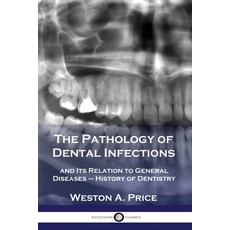 The Pathology of Dental Infections: and Its Relation to General Diseases - History of Dentistry Paperback, Pantianos Classics