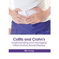 Colitis and Crohn's: Understanding and Managing Inflammatory Bowel Disease Hardcover, Hayle Medical