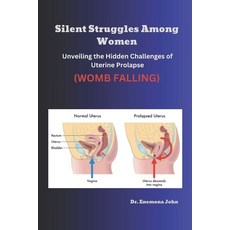 (영문도서) Silent Struggles Among Women: Unveiling the Hidden Challenges of Uterine Prolap... Paperback, Independently Published, English, 9798300001025