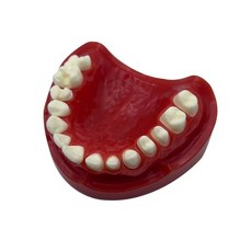 치석 치과 모형 착색 치아 자료 치주 상담 치과교육 상담자료 모형교구 진단용, 치과 반 입 도자기 준비 데모 모델 교체 가능