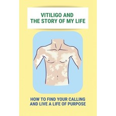 Vitiligo And The Story Of My Life: How To Find Your Calling And Live A Life Of Purpose: Vitiligo Soc... Paperback, Independently Published, English, 9798740389837