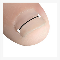 신짱컴퍼니 부러지지 않는 탄력최고 와이어팁, 1세트, 풀세트와이어팁18mm