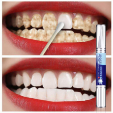 빠른 치아 미백 펜 누런 치아 담배 치아 차 얼룩 제거 전용 순한 케어로 치아를 밝게 하고 아름답게 가꾸는 치아 클리닝 펜 남녀 공용, 3개, 3ml