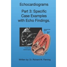 Echocardiograms - Part 3: Specific Case Examples with Echo Findings. Paperback, Independently Published, English, 9798570437494