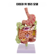 인체 치질 모형 직장 항문외과 해부학 병리학 A형 대장과 위 모델, 1개