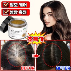 [순한성분] 줄기세포 탈모케어 크림 두피 에센스 영양제 헤어 두피 토닉 탈모 예방 증상완화 데일리 모낭 영양 LUPEIYA, 1개, 120g