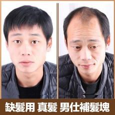 脫髮補髮增髮髮片 男仕補髮塊 100%真髮 自由造型 高仿真 逼真自然 假髮, 1個, 內網16X18 一般髮旋(無頭皮)