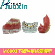 임플란트 모형 연습 상악동 기술자 놀이 신경 발치 구조 커뮤니케이션 실습, M6003 턱 임플란트 복원 모델