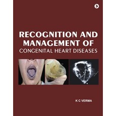 (영문도서) Recognition and Management of Congenital Heart Diseases Paperback, Notion Press, English, 9798890667366