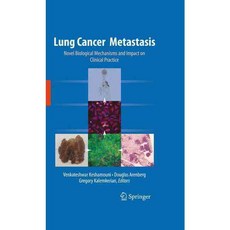 Lung Cancer Metastasis: Novel Biological Mechanisms and Impact on Clinical Practice, Springer Verlag