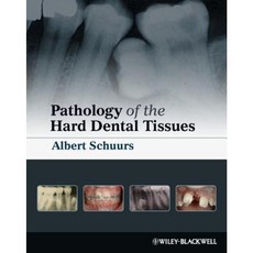 Pathology of the Hard Dental Tissues Hardcover, Wiley-Blackwell