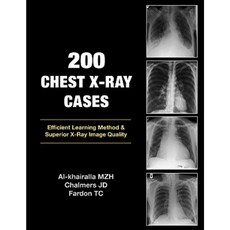 200 Chest X-Ray Cases Paperback, London Press