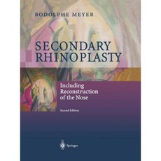 Secondary Rhinoplasty: Including Reconstruction of the Nose Paperback, Springer