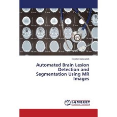 Automated Brain Lesion Detection and Segmentation Using MR Images Paperback, LAP Lambert Academic Publishing