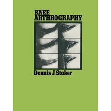 Knee Arthrography Paperback, Springer