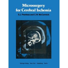 Microsurgery for Cerebral Ischemia Paperback, Springer