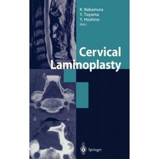 Cervical Laminoplasty Hardcover, Springer