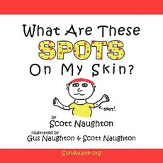 What Are These Spots on My Skin? Paperback, Authorhouse