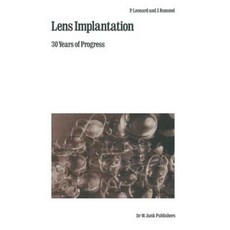 Lens Implantation: 30 Years of Progress Paperback, Springer