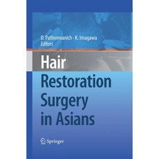 Hair Restoration Surgery in Asians Paperback, Springer
