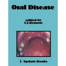 Oral Disease Paperback, Springer