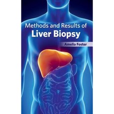 Methods and Results of Liver Biopsy Hardcover, Foster Academics