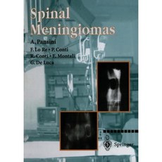 Spinal Meningiomas Paperback, Springer