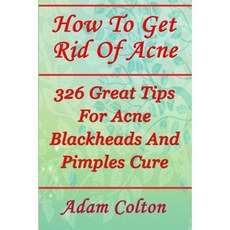 How to Get Rid of Acne: 326 Great Tips for Acne Blackheads and Pimples Cure Paperback, Createspace Independent Publishing Platform