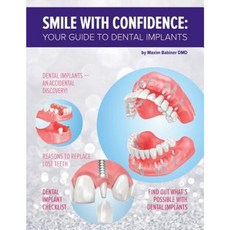 Smile with Confidence: Your Guide to Dental Implants Paperback, Createspace Independent Publishing Platform