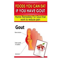 Foods You Can Eat If You Have Gout: Home Remedies for Gout That Work to Reduce Pain Paperback, Createspace Independent Publishing Platform