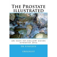 The Prostate Illustrated: In 10 Points Paperback, Createspace Independent Publishing Platform